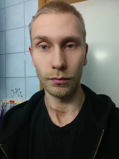 Leikkauksen jälkeen.webp